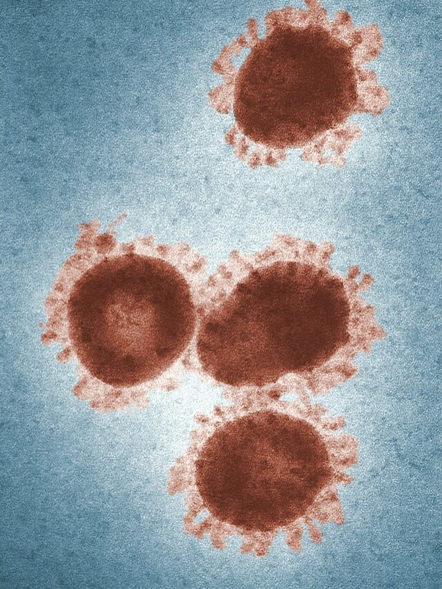 Pocket feature shared by deadly coronaviruses could lead to pan-coronavirus antiviral treatment